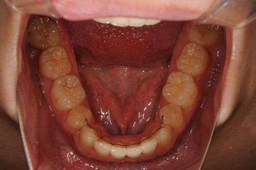 %e8%a6%aa%e3%81%97%e3%82%89%e3%81%9aupright