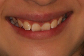 %e5%90%8d%e7%a7%b0%e6%9c%aa%e8%a8%ad%e5%ae%9a-1