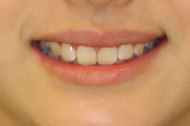 %e5%90%8d%e7%a7%b0%e6%9c%aa%e8%a8%ad%e5%ae%9a-2