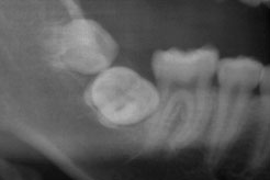 %e5%9f%8b%e4%bc%8f7%e7%95%aa