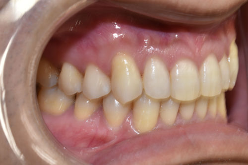 %e8%a1%93%e5%be%8c%e5%8f%b3