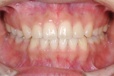 %e9%96%8b%e5%92%ac%ef%bc%92